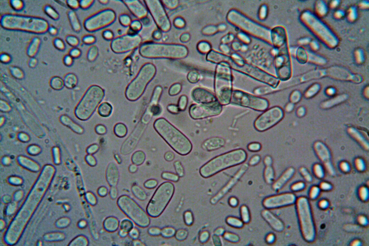 Escherichia coli bacteria
