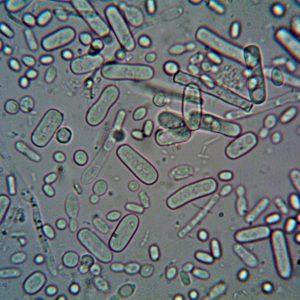 Bakterie Escherichia coli