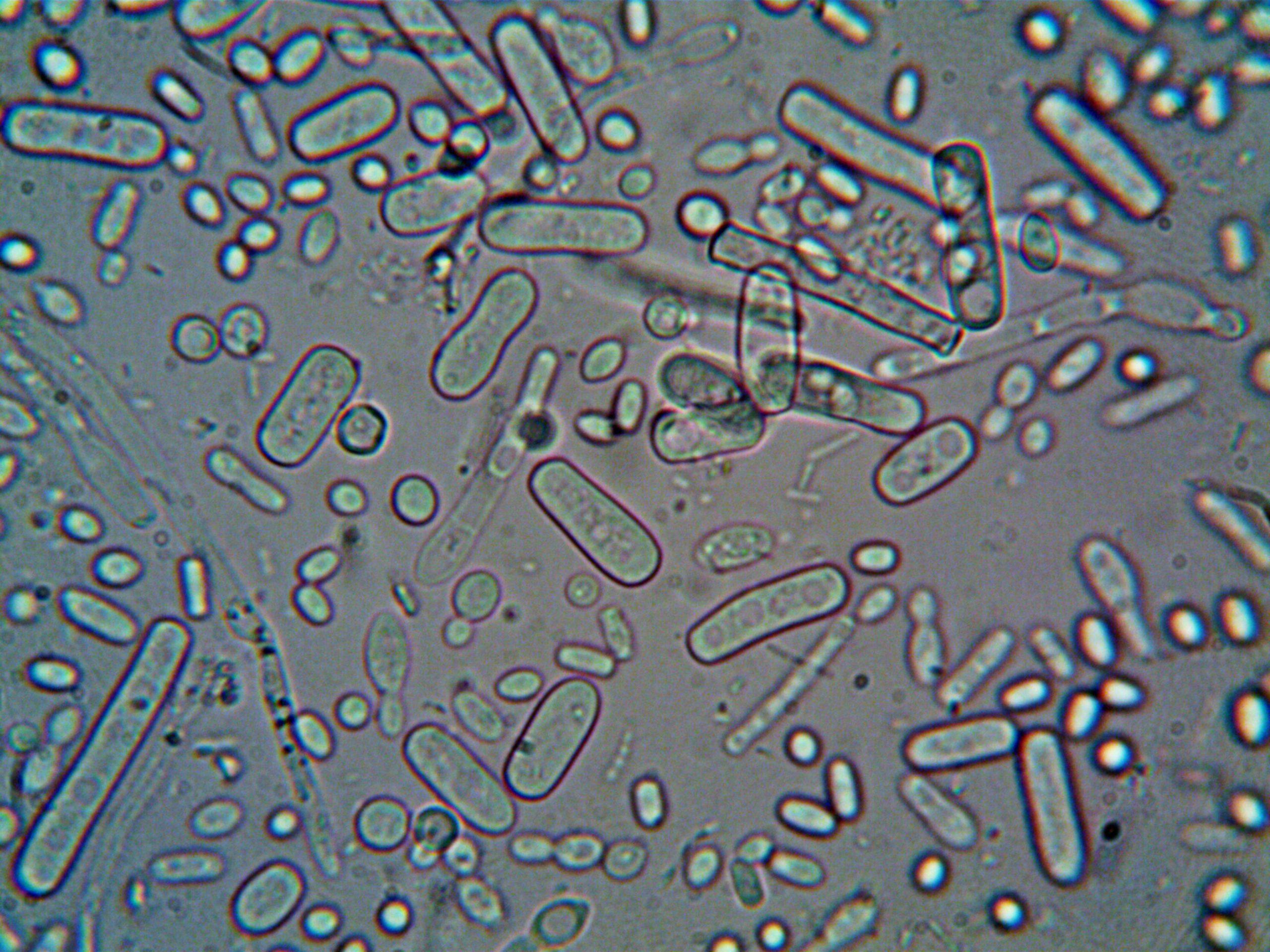 Escherichia coli Bakterien